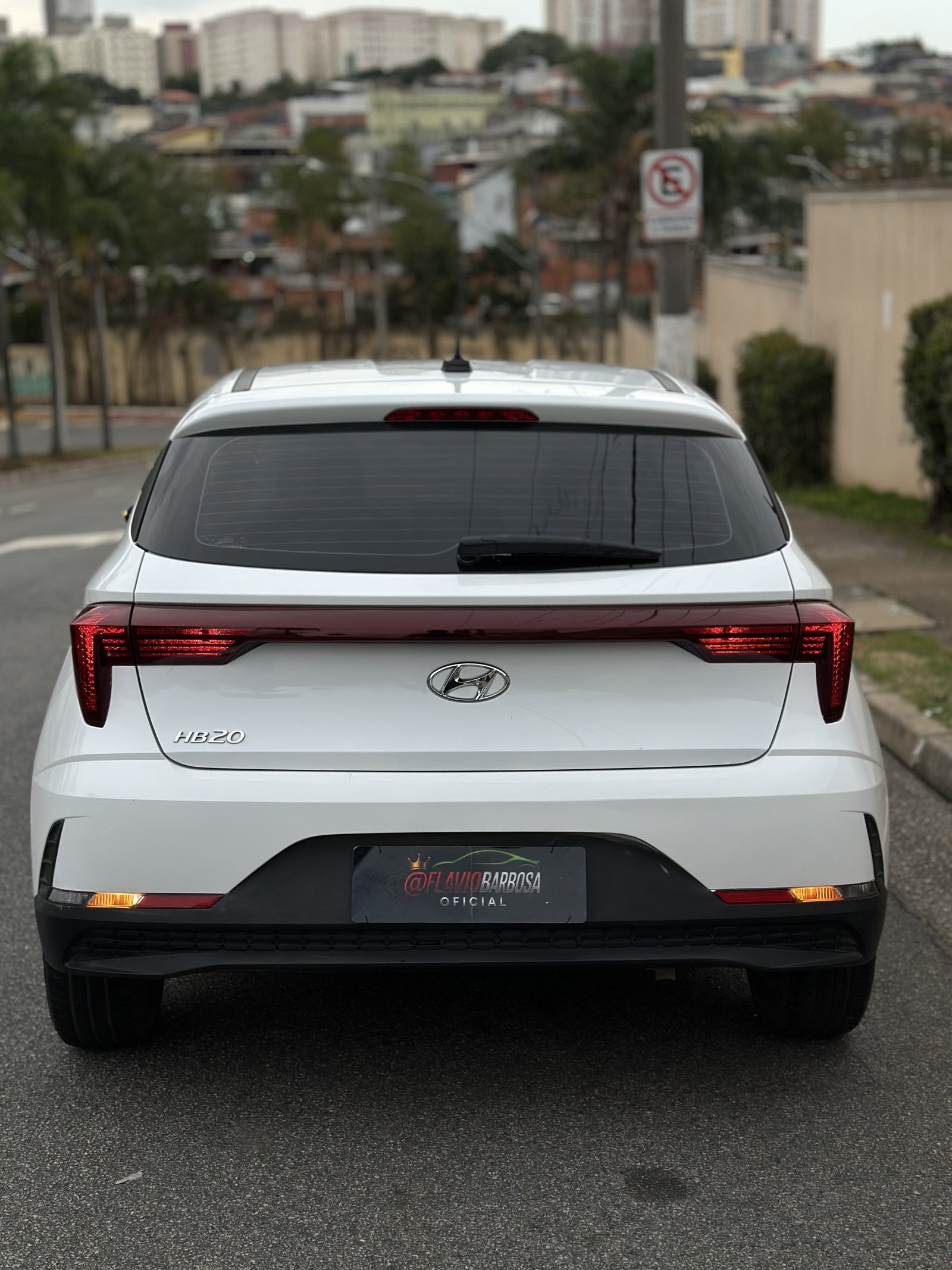HB20 Confort 2024 🚘 Edição 02